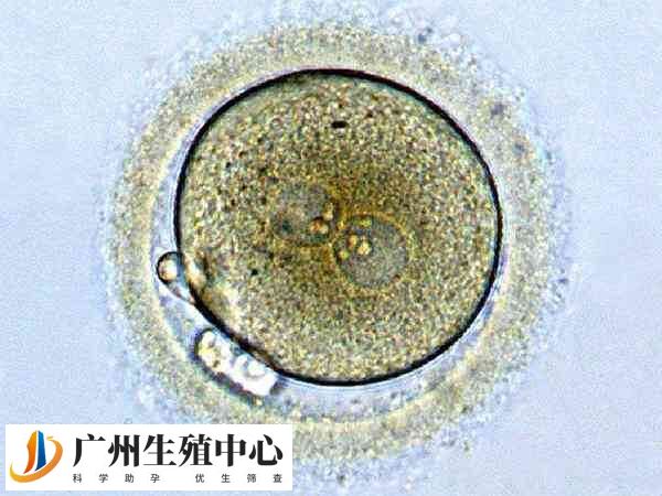 移植冻囊胚不出血是失败了吗