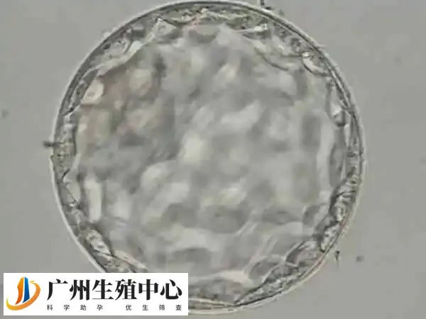 胚胎移植后要注意观察雌二醇值