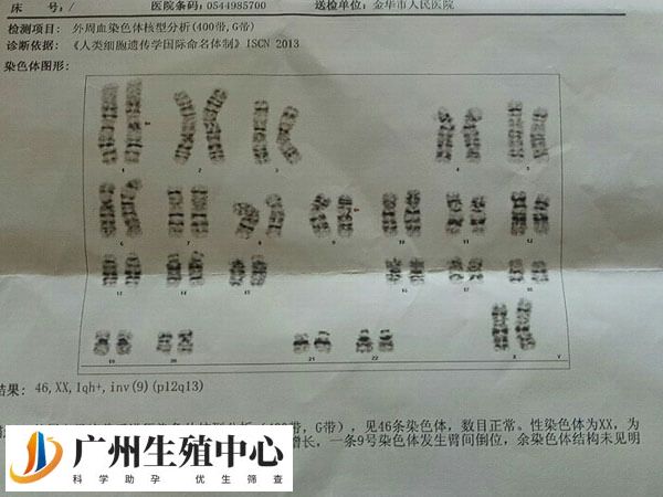 TTC21A基因突变是单基因疾病