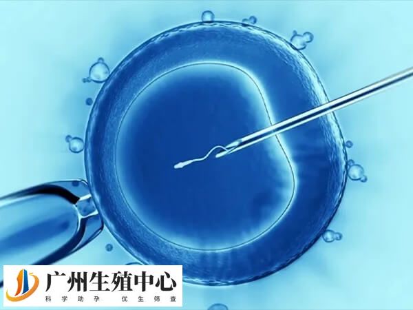 试管婴儿手术是一项颇具风险的生育方式