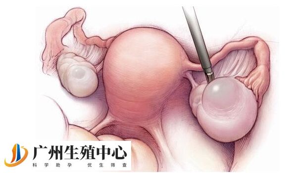 试管促排针后一次取卵8-15