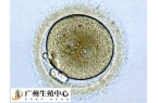 移植冻囊胚不出血是失败了吗